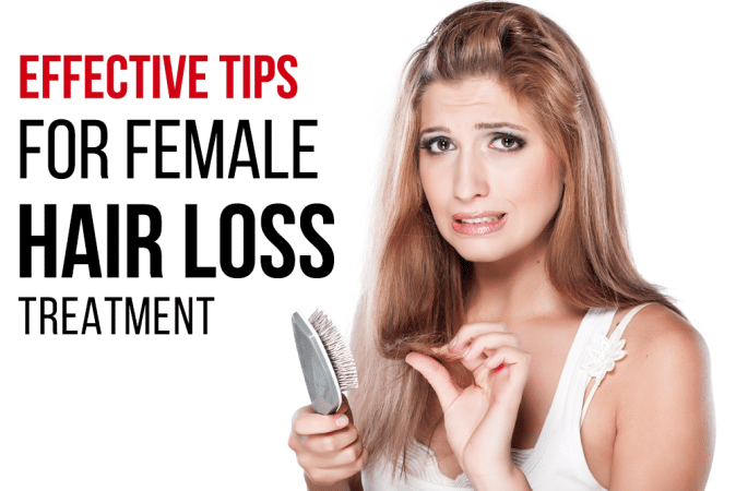 Female Hair Loss treatment