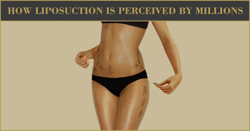 How Liposuction Is Perceived By Millions