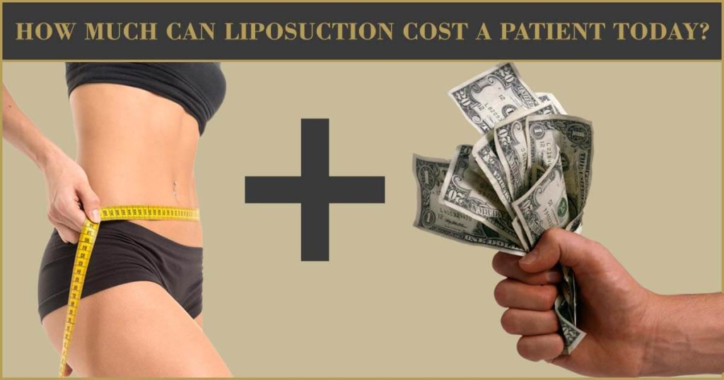 How Much Can Liposuction Cost A Patient Today?