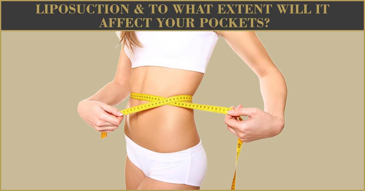 Liposuction & To What Extent Will It Affect Your Pockets?
