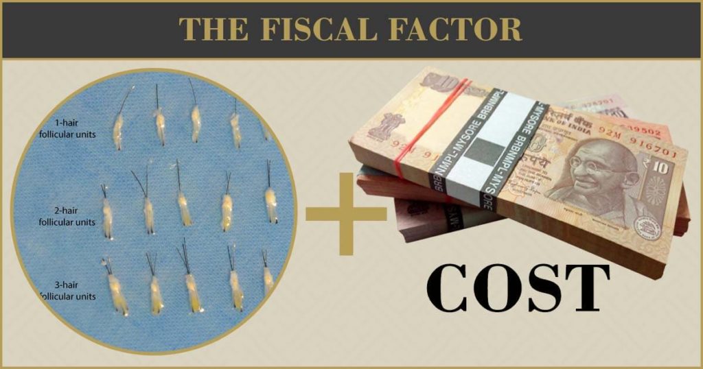 The fiscal factor