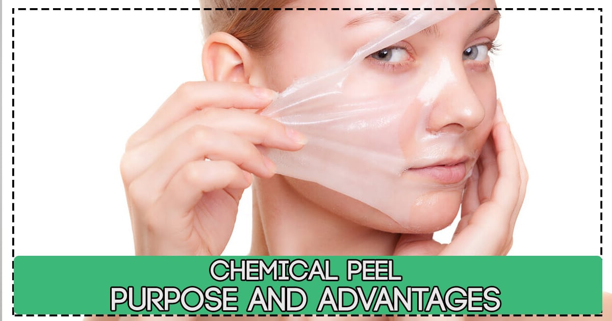 Chemical Peel - Purpose and Advantages
