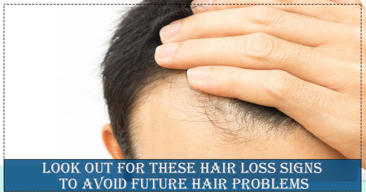 Look Out for These HAir Loss Signs To Avoid Future hair problems