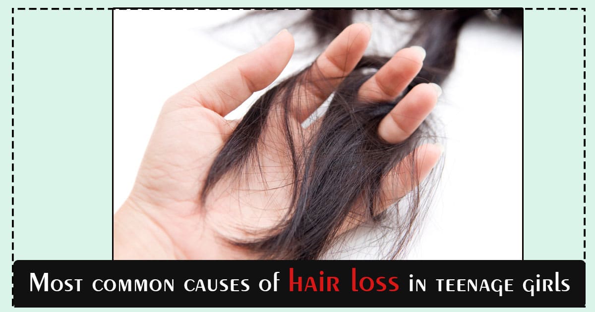Most common causes of hair loss in teenage girls