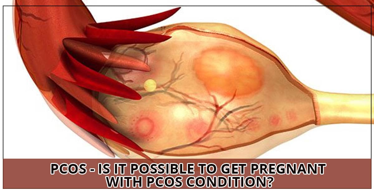 PCOS - Is it possible to get pregnant with PCOS Condition