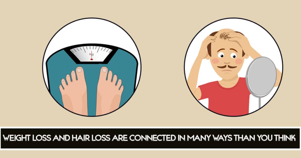 WEIGHT LOSS AND HAIR LOSS ARE CONNECTED IN MANY WAYS THAN YOU THINK