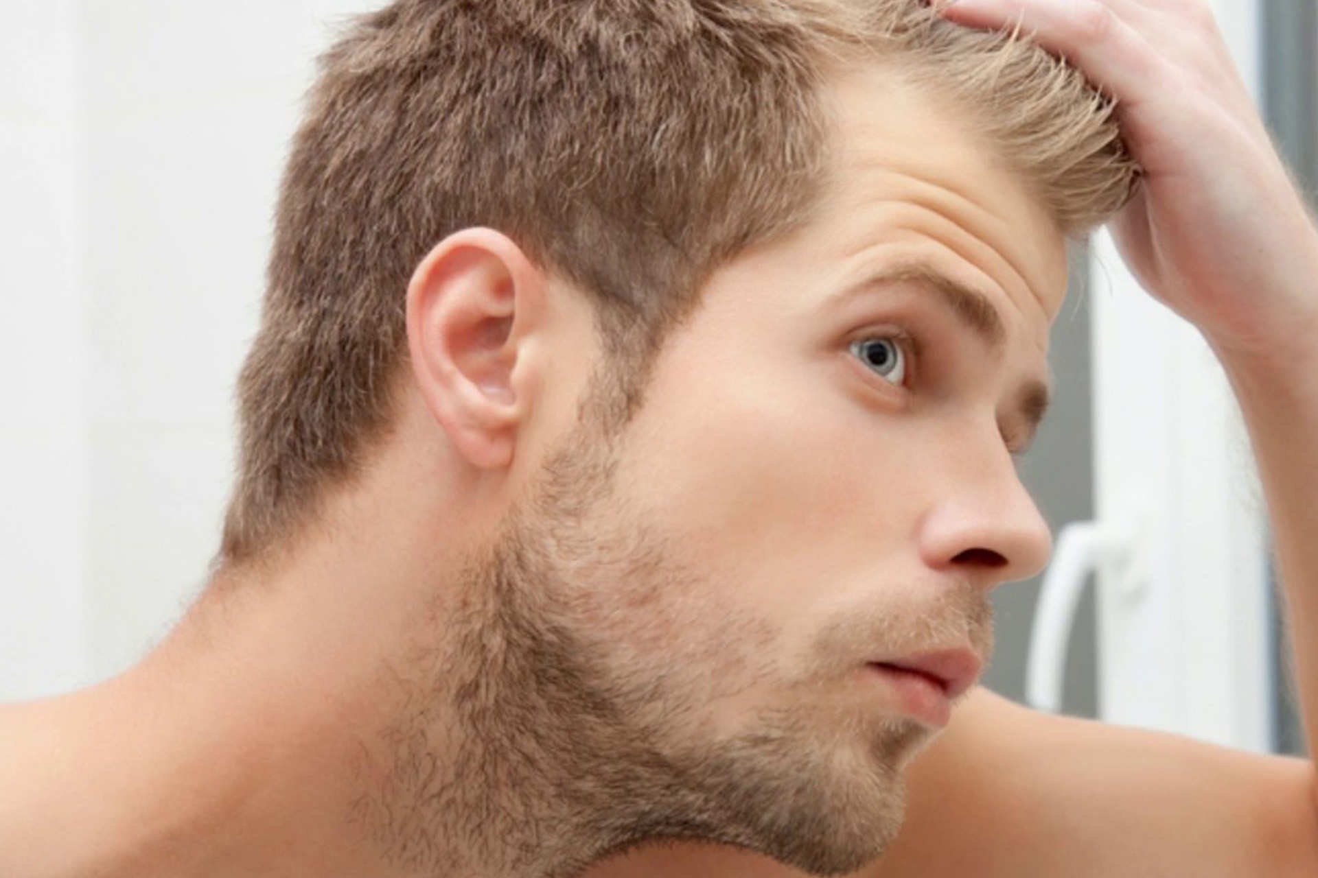 Лысина у мужчин. Людей о его волосах. Мужчина с красивыми волосами. Людей о его волосах. Людей о его волосах.