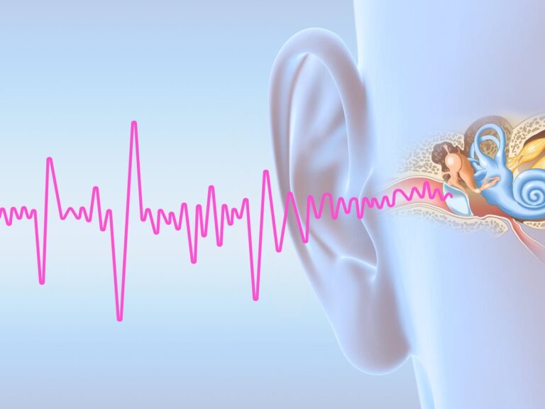 Is There a Cure For Tinnitus? 2024 Guide Sound Health Doctor